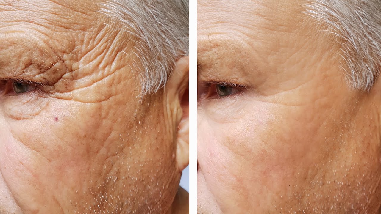 تصویر 3 از خرید وازلین بهداشتی ضد چروک صورت + قیمت فروش استثنایی